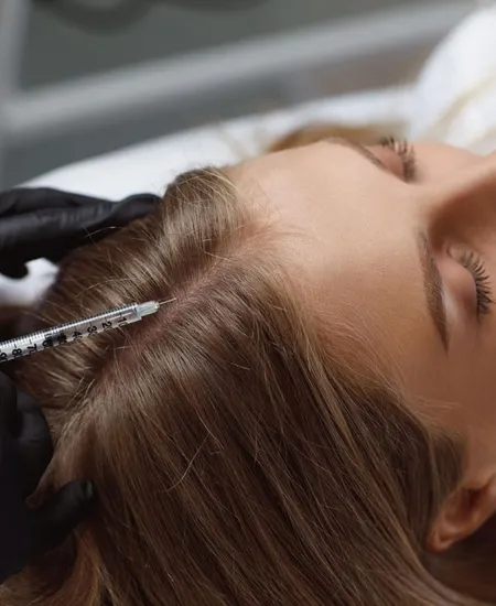 Hair Mesotherapy Treatment