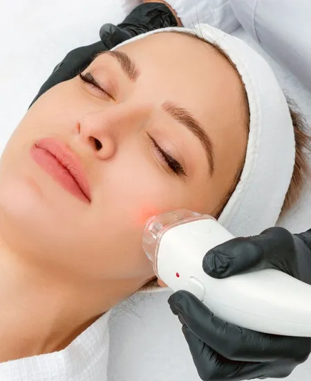Laser Hair Removal Treatment