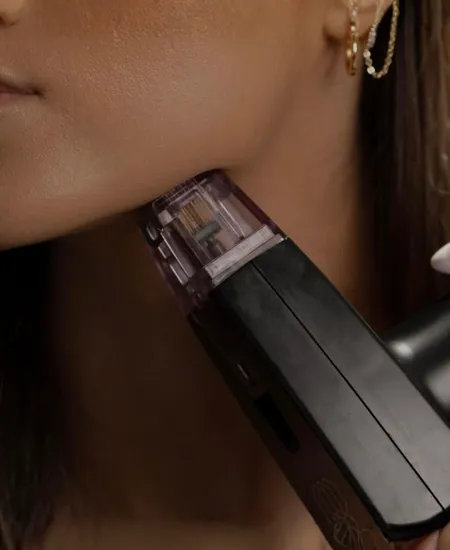 Morpheus 8 Treatment