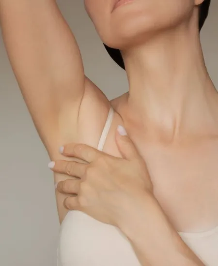 Underarms Botox Treatment