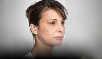 Before Cellulite Treatment